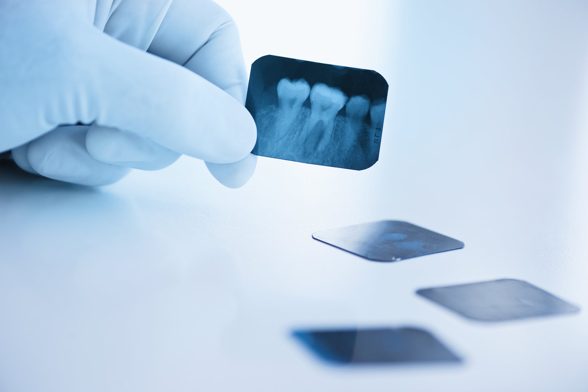 Radiografias odontológicas sendo analisadas